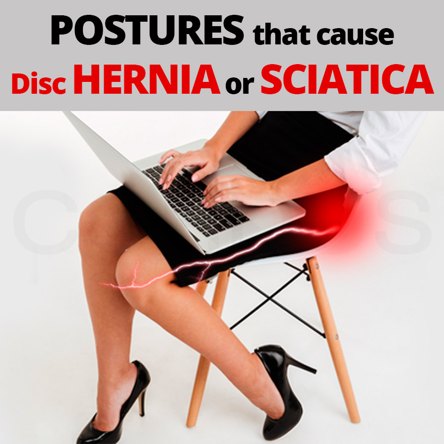 These sitting postures cause sciatica or herniated disc