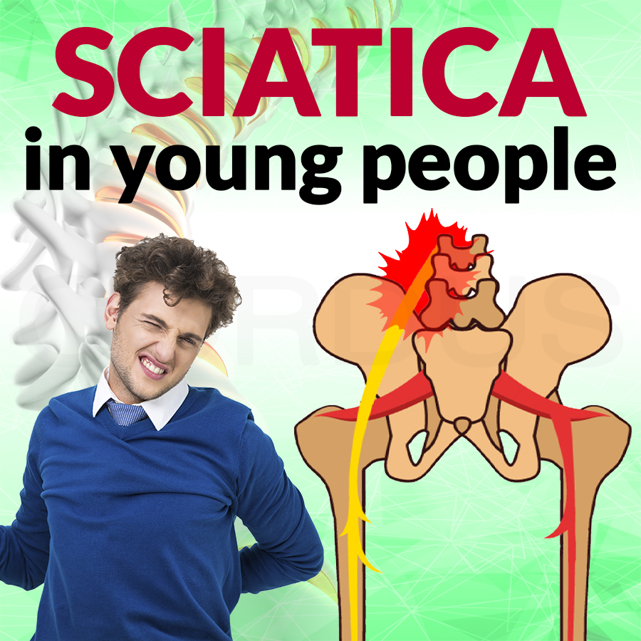 Sciatic nerve pain in young people